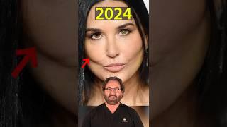 Demi Moore’s New Face (2024) | Plastic Surgeon Reacts