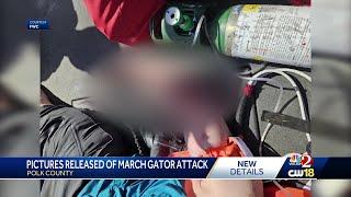 'There's an alligator on my arm': Polk County gator attack report released