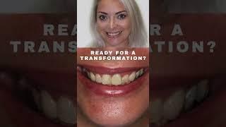 Creative Before & After Smile Makeover