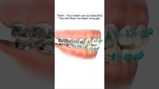 Don’t forget your retainers as well  #smile #braces #orthodontist  #invisalign #dentist #alignment