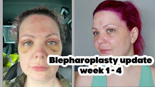 Blepharoplasty recovery process day 7 to week 4 | after stitches removal