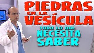 PIEDRAS EN LA VESÍCULA - Todo lo que necesita saber - Enfermedades #19