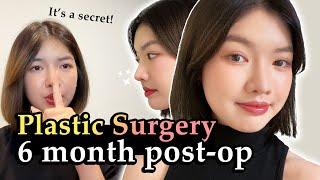 SIX MONTHS REVIEW... | Braun Plastic Surgery