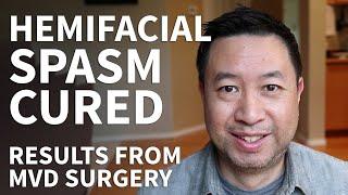 Hemifacial Spasm Surgery Recovery - Hemifacial Spasm Stories and MVD Surgery Cure