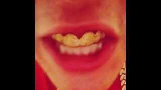 Justin Bieber Gets Gold Grill For His Teeth