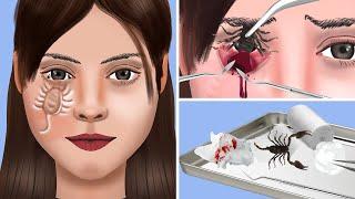 ASMR Treatment And Removal Of Scorpio From Infected Skin - ASMR Skin Care Animation | JINJJA 진짜 ASMR