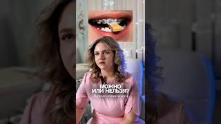 МОЖНО ИЛИ НЕЛЬЗЯ | Стоматолог отвечает на вопросы  #стоматология #стоматологиямосква