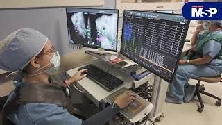 Procedimiento de catéter OPTRELL desde el Centro Cardiovascular de Puerto Rico y el Caribe