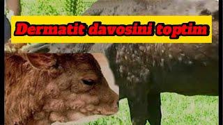 DERMATIT DAVOSINI TOPTIM XUDO XOXLASA 28.10.2024.