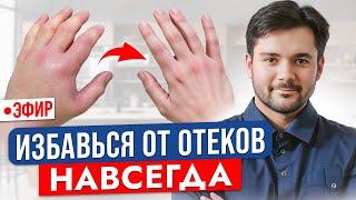 Делайте это, чтобы избавиться от отеков навсегда. Главные причины отеков.