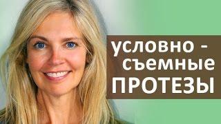  Протез на имплантах. Что такое условно съемный протез зубов на имплантах? Стоматология Тандем