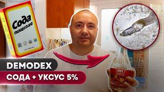 Сода против клеща # 1 | Угревая Железница Demodex