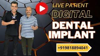 Can Dental Implants Really Change Your Life?