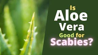 Aloe Vera for Scabies - Is it Good, Does Aloe Vera Help Kill Scabies?