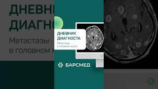 Метастазы в головном мозге МРТ пациента описал Ахатов А.Ф. - лучший рентгенолог Татарстана #shorts