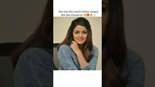 She was the cutest before surgery but she choose to #bollywood #viralvideo #trending #favedit02