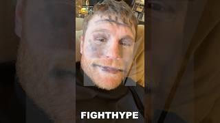 CANELO BATTERED & BRUISED ZOMBIE NINJA; LETS DAUGHTER PAINT HIS FACE FOR HALLOWEEN 2023 OUTFIT