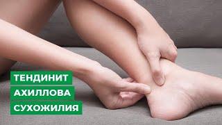 Тендинит Ахиллова сухожилия: симптомы, диагностика, лечение.