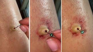 Pin Wound | SFX MAKEUP *WARNING GRAPHIC*