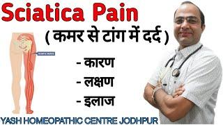 Sciatica ( Hip thigh leg ) nerve pain ।Cause symptoms । Best homeopathic treatment