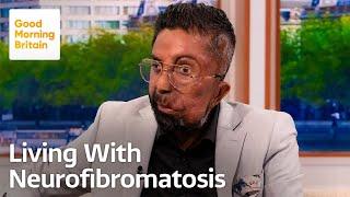 Born Different: How Amit Ghose Turned His Pain into Purpose