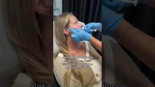 Radiesse Cheek Filler at Dermfx Medspa!