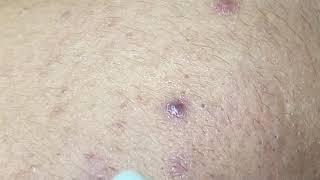 Relax With Hien Nguyen Spa #678