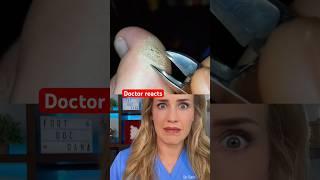 Doctor reacts: foot callus art?