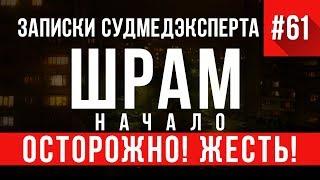 Записки Судмедэксперта #61.1 «Шрам» (Осторожно, ЖЕСТЬ!)