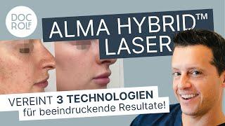 Neu: ALMA (CO2) HYBRID™ LASER - die Innovation der Hautverjüngung - Dr. Rolf & Katrin Bartsch