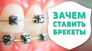 Зачем ставить брекеты? | Опрос на улицах Новосибирска | Дентал ТВ