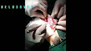 Quick Perineal Hernia Surgery