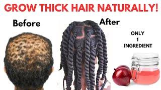 USE ONION JUICE TO GROW THICK HAIR NATURALLY! l ONIONS FOR EXTREME HAIR GROWTH AT HOME