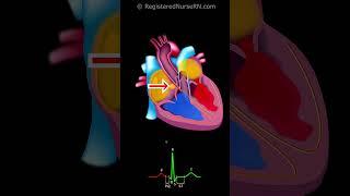 Cardiac Conduction System Electrical Signal Animation with ECG /EKG Waveform