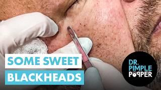 Sweet Sounds. Sweet Pops. Just Blackheads.