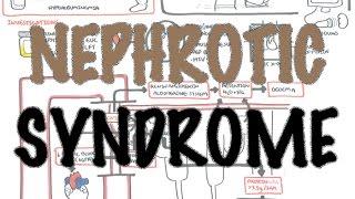 Nephrotic Syndrome - Overview (Sign and symptoms, pathophysiology)