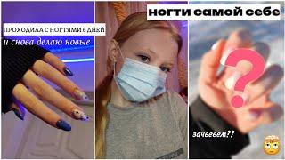 ноготочки себе спустя 6 дней*шок*