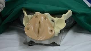 Gynaecological Pelvic Examination