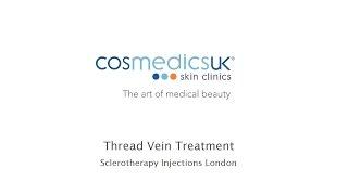 Cosmedics Skin Clinics Thread Vein Injections