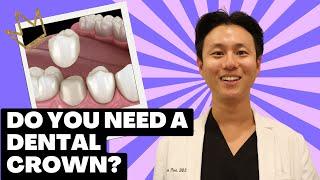 Do I Need a DENTAL CROWN? | Dentist Answers