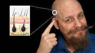 How to avoid Razor Bumps on your Head