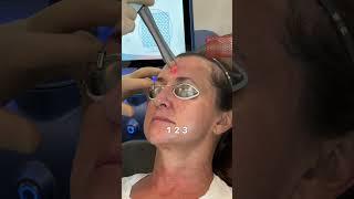 Revolutionize Your Skin with UltraClear Laser Technology