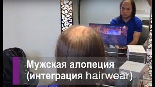 Мужская алопеция - больше не проблема! Наращивание системы интеграции hairwear