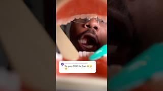 Doctor Hard Gets to Work: Ryan’s Full Mouth Rehab with Dental ASMR  #dentistasmr