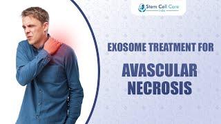 The Future of Avascular Necrosis Treatment: Exosome and Stem Cell Therapy |