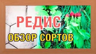 РЕДИС ДИЕГО И РОДРИГЕС