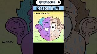 Horner's Syndrome Mnemonics USMLE MADE EASY