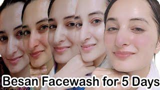 5 Days Skin Whitening Challenge | I Used Besan Magical Facewash and See What Happened