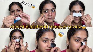 Honest review is Blackhead remover ||removed facial hair too ?? #blackhead #review