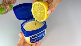 Mix Vaseline with Lemon and you will be shocked! If only I had known about this earlier!